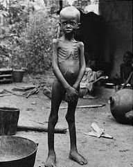 Starving Children